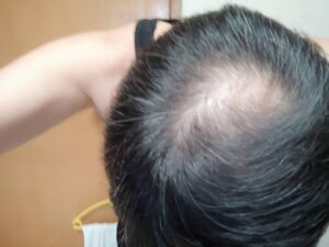 5月17日、13日目